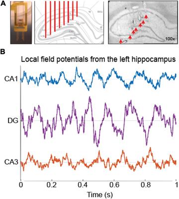 Theta and gamma oscillations in the rat hippocampus support the discrimination of object displacement in a recognition memory task